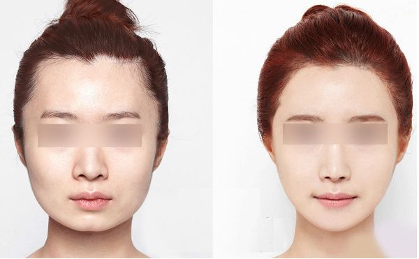 深圳有哪些專業(yè)整形醫(yī)院值得推薦？