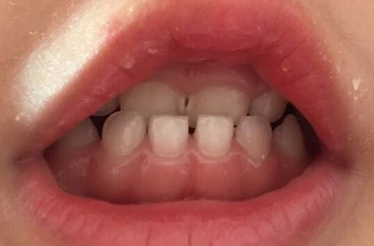 鄭州瑞顏會(huì)整形醫(yī)院，誠(chéng)信專業(yè)值得信賴