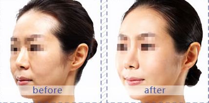 郴州市優(yōu)質(zhì)整形醫(yī)院推薦排行榜