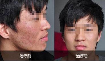 酒泉維爾麗整形醫(yī)院醫(yī)生團(tuán)隊(duì)精湛技藝，專(zhuān)業(yè)特色項(xiàng)目讓您心動(dòng)！