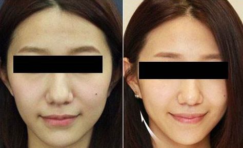 臨沂市哪家整形美容醫(yī)院口碑比較好？