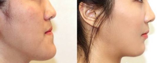 重慶軍科整形美容醫(yī)院口碑如何？醫(yī)生技術看評價，了解綜合實力！