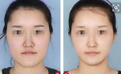 鄭州眼睛修復哪家醫(yī)院效果好