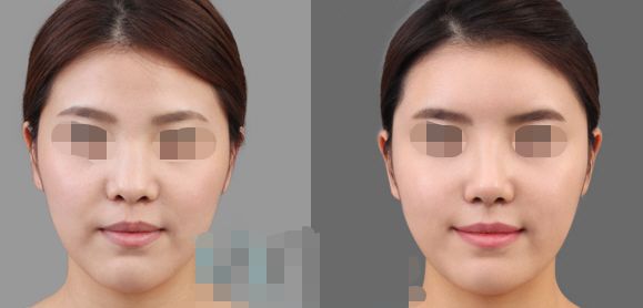 長春市更受歡迎的整形醫(yī)療機(jī)構(gòu)揭曉