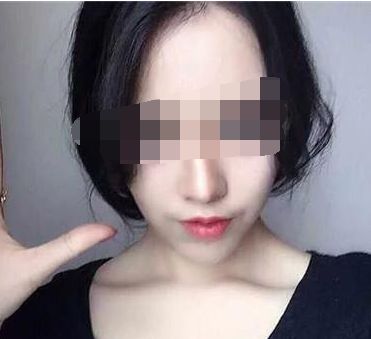 昆明市的美容整形醫(yī)院有哪些值得推薦？