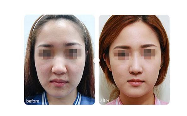 廣州優(yōu)質(zhì)磨骨整形醫(yī)院推薦！TOP10醫(yī)療機構(gòu)揭秘