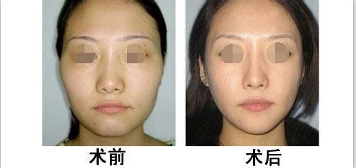 蘭州有哪些專業(yè)整形醫(yī)院值得去？