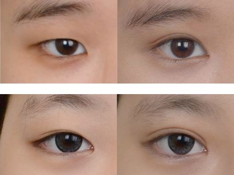 同仁植發(fā)名醫(yī)大比拼：李發(fā)成 VS 馮蘇云