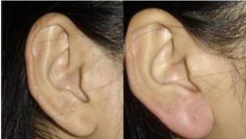 河南耳朵再造醫(yī)院排名榜單：鄭州南陽(yáng)最佳耳部整形醫(yī)院盤點(diǎn)