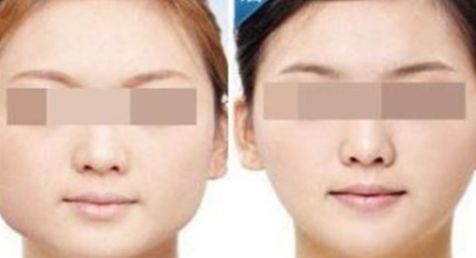 2024大連哪家醫(yī)院吸脂效果最好？這里有前十名匯總！