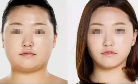 選擇合適的烏魯木齊鼻整機構，幫助你實現(xiàn)理想鼻形