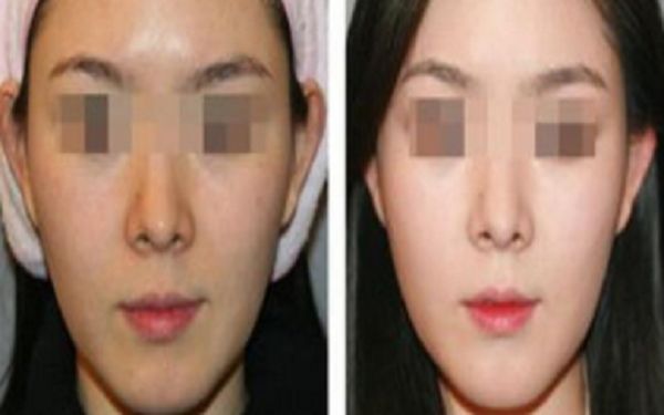 銅陵博愛醫(yī)院醫(yī)療美容科，專業(yè)醫(yī)生技術如何？