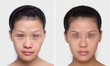 沙醫(yī)生整形大連收費揭秘！院內(nèi)價格表詳解，看看整形費用是否貴？