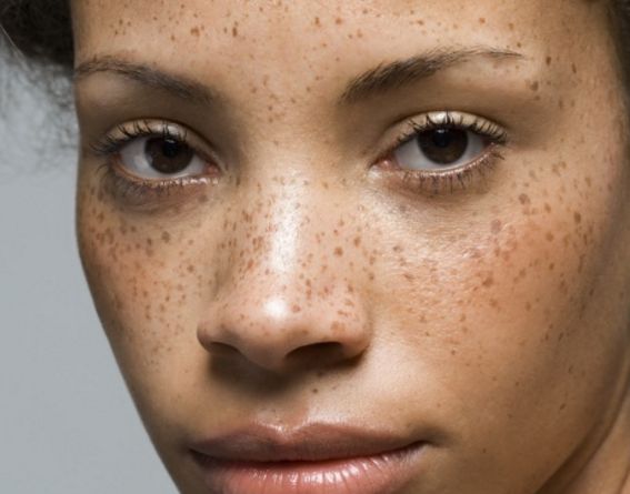 北京雙眼皮手術(shù)哪家醫(yī)院好？專業(yè)推薦前三名