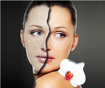 微拉美和埋線提升術(shù)，價格及效果大比拼!