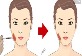 阜陽值得信賴的眼科醫(yī)院推薦與近視手術(shù)費(fèi)用參考