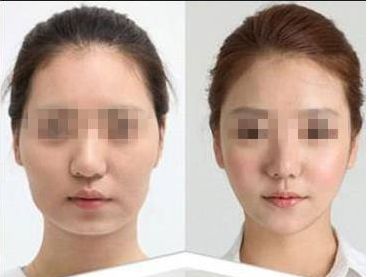 廈門(mén)市整形外科醫(yī)院綜合排名報(bào)道