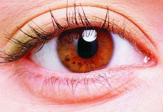 常州雙眼皮醫(yī)院哪家術(shù)后效果好？推薦自然媽生款雙眼皮醫(yī)院！