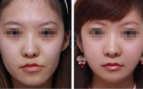 【2024】西安微整形醫(yī)院哪家好？排行榜大揭秘！