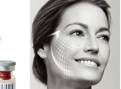 杭州靜港醫(yī)療美容醫(yī)院專家團隊解讀眼部整形案例