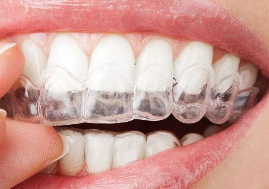 深圳景田萬(wàn)曉楠面部提升術(shù)：專業(yè)技術(shù)，完美蛻變見(jiàn)證