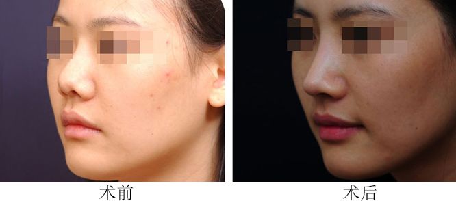 長春哪家整形醫(yī)院口碑年度最佳，排名比較好