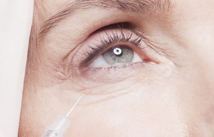 告別熊貓眼：黑眼圈消除與日常護理指南