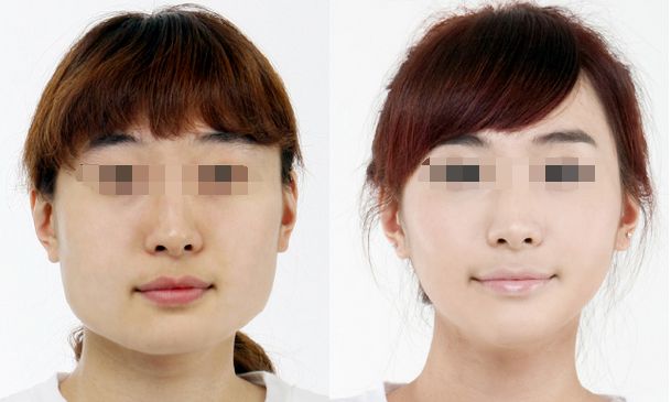 南京吸脂整形排名前十強醫(yī)院列表