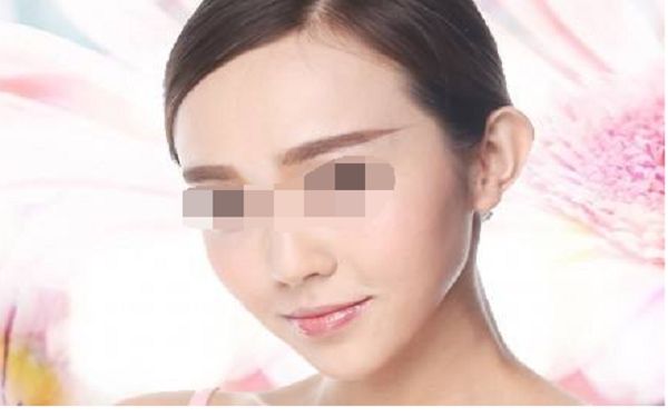 北京碧蓮盛發(fā)際線種植技術(shù)怎么樣？