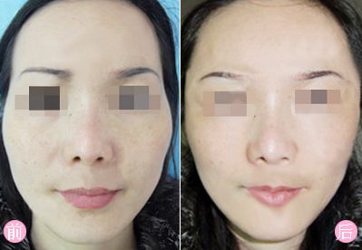 青島金泰諾整形診所最新報(bào)價(jià)單和醫(yī)生評(píng)價(jià)公布！