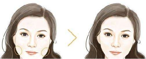 佛山生命加整形美容價格大揭秘，張春光元氣美狐眼等你了解