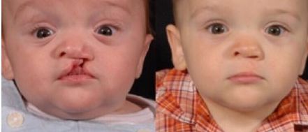 愛美人士必看！艾莉薇PK伊婉玻尿酸，功效、使用范圍、持久度對(duì)比