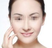 揭秘惠州市受歡迎雙眼皮手術(shù)醫(yī)院推薦TOP10