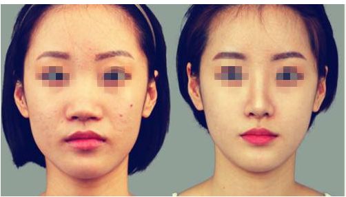 泉州哪些醫(yī)院擅長整形手術(shù)？