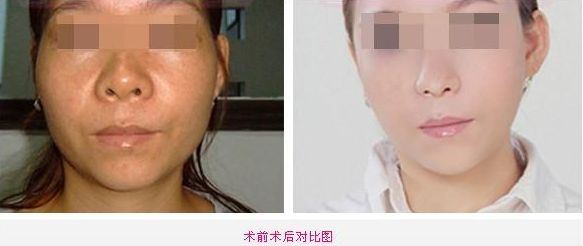 全新整容醫(yī)院推薦！這5家值得你關(guān)注