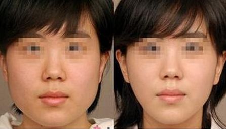 上海醫(yī)美三強競爭激烈！公立九院實力領(lǐng)跑