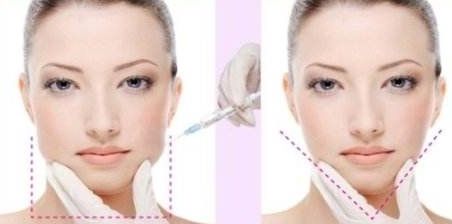 2024年成都哪家正畸醫(yī)院口碑好？價格查詢澤西醫(yī)生正畸美團(tuán)優(yōu)惠