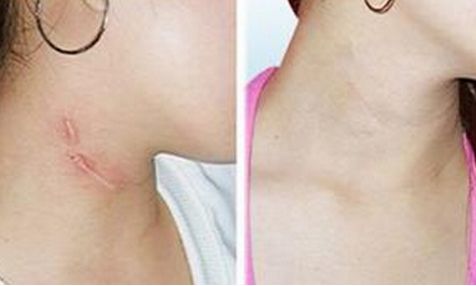 中國權威的豐胸醫(yī)院排行榜出爐，哪家效果最佳？