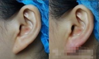 湖州哪家醫(yī)院能有效提升面部外觀？