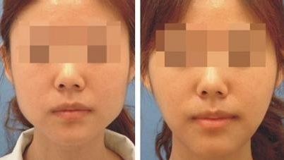 廣州中家醫(yī)家庭醫(yī)生整形美容醫(yī)院價(jià)目表及專(zhuān)家推薦