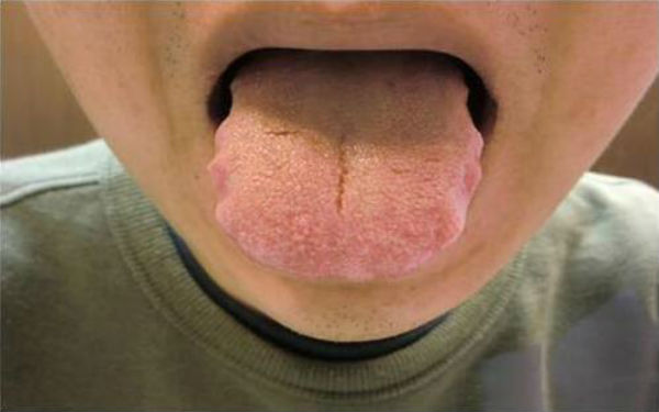 岳陽(yáng)激光點(diǎn)陣去痘坑醫(yī)生