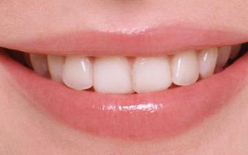 廣東激光祛斑美白醫(yī)生