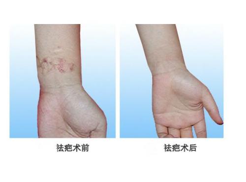 濟南重瞼醫(yī)生