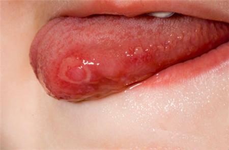 信陽精雕瘦腰部醫(yī)生