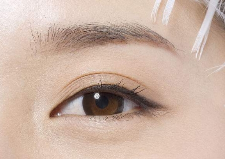 廣州提拉眼周紋醫(yī)生