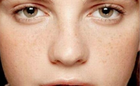 海南隆鼻用進口假體醫(yī)生