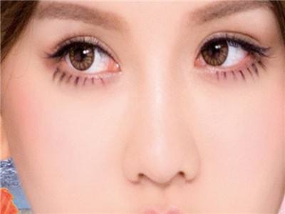 蘇州自體填充淚溝醫(yī)生