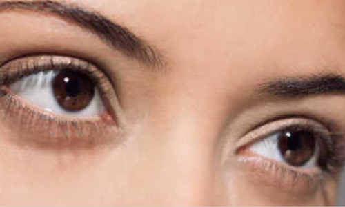 寧波點陣祛動態(tài)細紋醫(yī)生