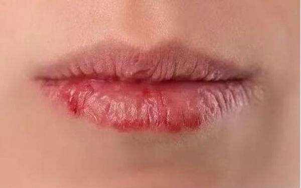 濟(jì)南下垂鼻修復(fù)醫(yī)生