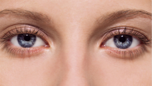 上海OPT祛斑醫(yī)生